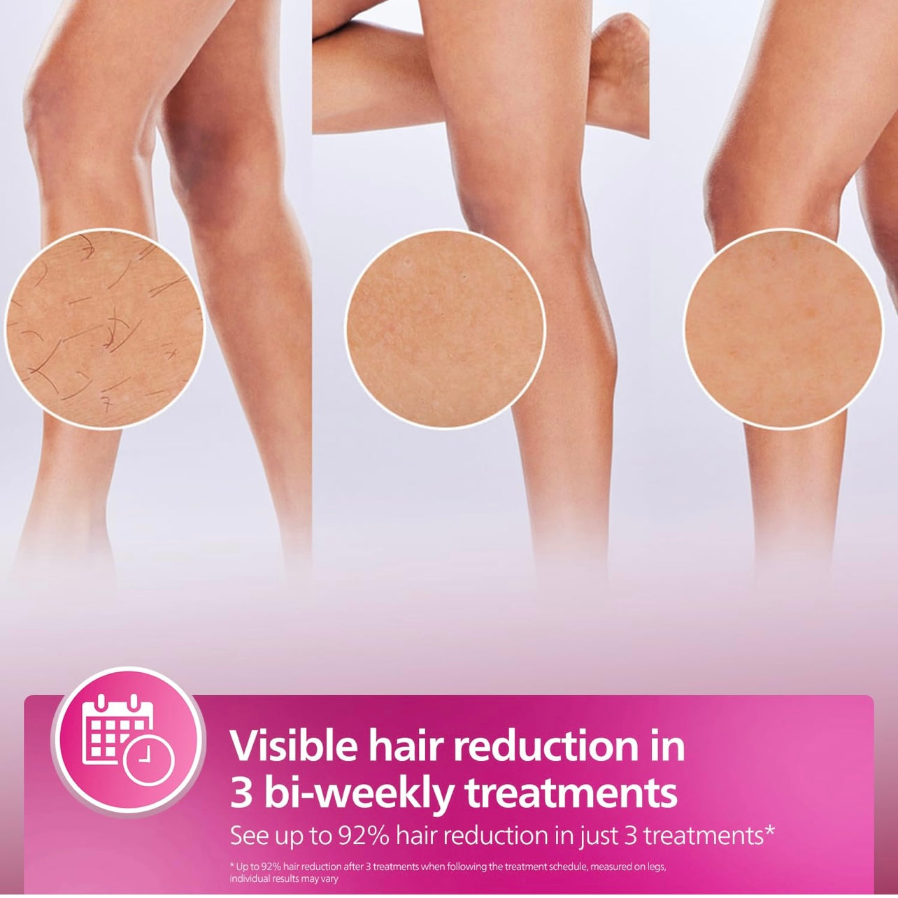 Philips IPL Hair Remover – Smooth, Painless Hair Removal at Home